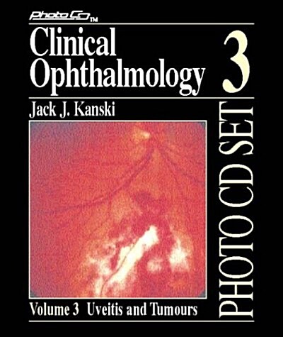 Uveitis and Tumours (Audio CD)