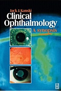 Clinical Ophthalmology (Paperback)