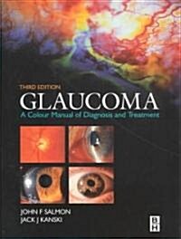 Glaucoma (Hardcover, 3rd)