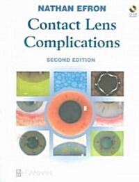 Contact Lens Complications (Paperback, CD-ROM, 2nd)