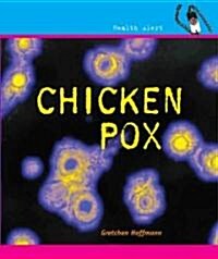 Chicken Pox (Library Binding)