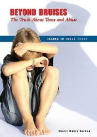 Beyond bruises(The)truth about teens and abuse 표지이미지
