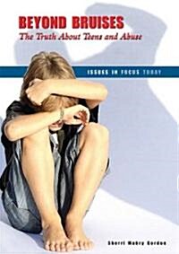 Beyond Bruises: The Truth about Teens and Abuse (Library Binding)