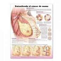 Entendiendo el cancer de mama / Understanding Breast Cancer Anatomical Chart (Chart, 3rd, Wall)