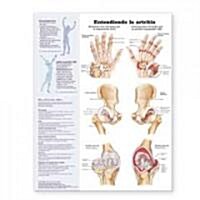 Entendiendo la artritis / Understanding Arthritis Anatomical Chart (Chart, Wall)