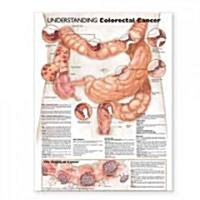 Understanding Colorectal Cancer Anatomical Chart (Other)
