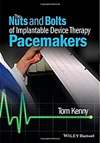 The Nuts and Bolts of Implantable Device Therapy: Pacemakers (Paperback)