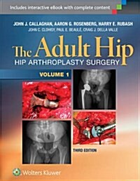 The Adult Hip (Two Volume Set): Hip Arthroplasty Surgery (Hardcover, 3)