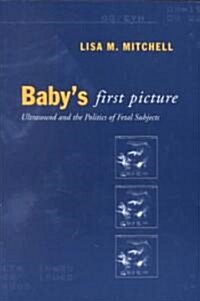 Babys First Picture: Ultrasound and the Politics of Fetal Subjects (Paperback)