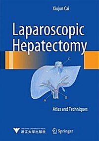 Laparoscopic Hepatectomy: Atlas and Techniques (Hardcover, 2015)