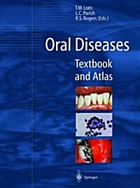 Oral Diseases (Hardcover)