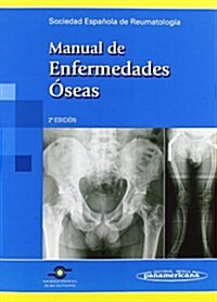 Manual De Enfermedades Oseas / Bone Diseases Manual (Paperback, 2nd)
