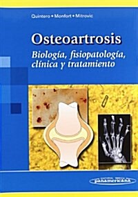 Osteoartrosis / Osteoarthritis (Paperback, 1st)