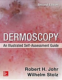 Dermoscopy: An Illustrated Self-Assessment Guide, 2/E (Paperback, 2, Revised)