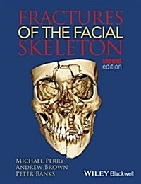 Fractures of the Facial Skelet (Paperback, 2, Revised)