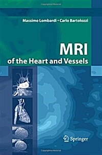 MRI of the Heart and Vessels (Paperback)