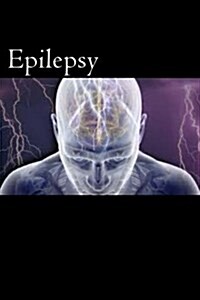 Epilepsy (Paperback)