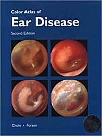 Color Atlas of Ear Disease (Book ) [With CDROM] (Hardcover, 2nd)
