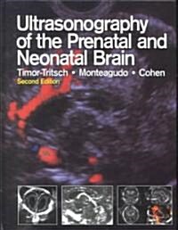 Ultrasonography of the Prenatal and Neonatal Brain (Hardcover, 2nd, Subsequent)