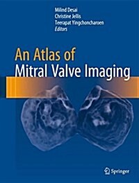 An Atlas of Mitral Valve Imaging (Hardcover)