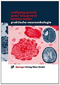 Praktische Neuroonkologie (Paperback)