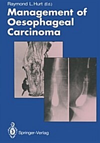 Management of Oesophageal Carcinoma (Paperback)
