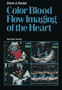 Color Blood Flow Imaging of the Heart (Paperback)