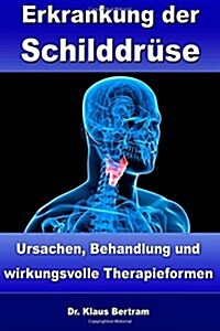 Erkrankung Der Schilddr?e (Paperback)