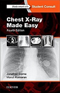 Chest X-Ray Made Easy (Paperback, 4 ed)