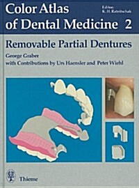 Removable Partial Dentures (Hardcover)