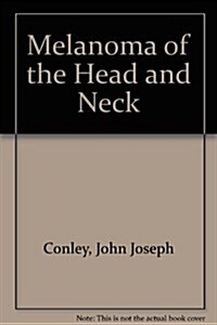 Melanoma of the Head and Neck (Hardcover)