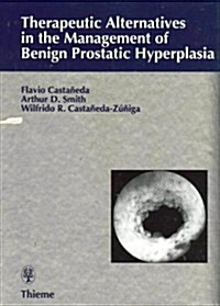 Therapeutic Alternatives in Management of Benign Prostatic Hyperplasia (Hardcover)