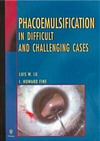 Phacoemulsification in Difficult and Challenging Cases (Hardcover)
