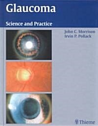 Glaucoma: Science and Practice (Hardcover)
