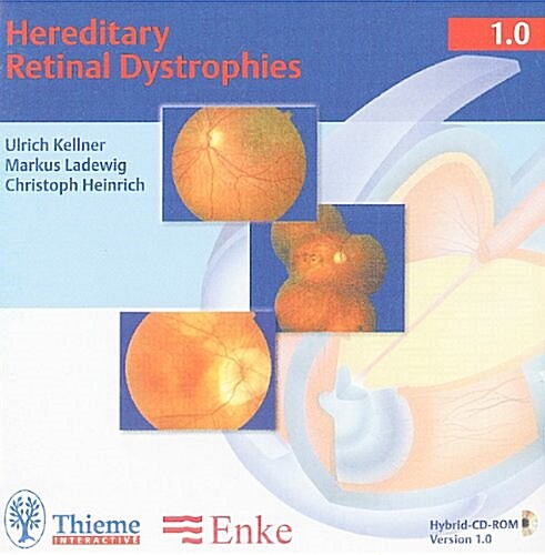 Hereditary Retinal Dystrophies (Other)