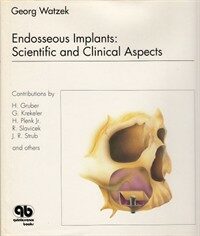 Endosseous implants : scientific and clinical aspects