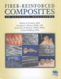 Fiber-reinforced composites in clinical dentistry