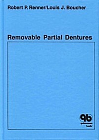 Removable Partial Dentures (Hardcover)