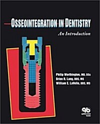 [중고] Osseo Integration in Dentistry (Paperback)