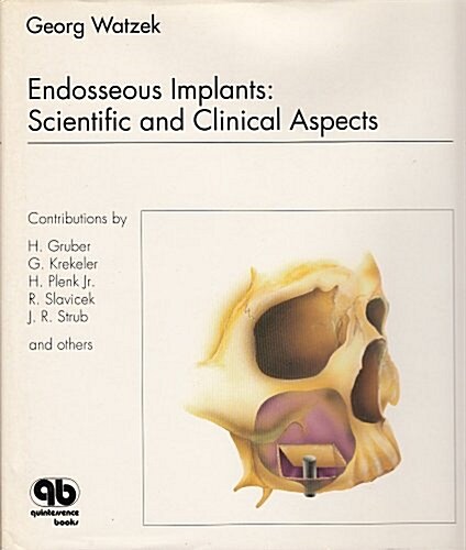 Endosseous Implants (Hardcover)