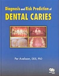 Diagnosis and Risk Prediction of Dental Caries (Hardcover)