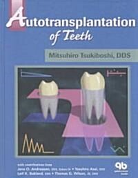 Autotransplantation of Teeth (Hardcover)