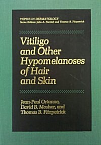 Vitiligo and Other Hypomelanoses of Hair and Skin (Hardcover)