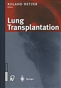 Lung Transplantation (Paperback)