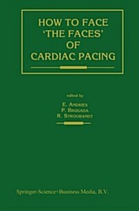 How to Face The Faces of Cardiac Pacing (Paperback, Softcover Repri)