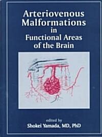Arteriomalformations in Functional Areas of the Brain (Hardcover)