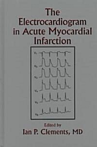 The Electrocardiogram in Acute Myocardial Infarction (Hardcover)