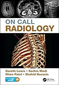 On Call Radiology (Paperback)