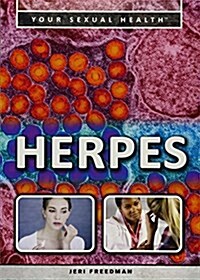 Herpes (Paperback)