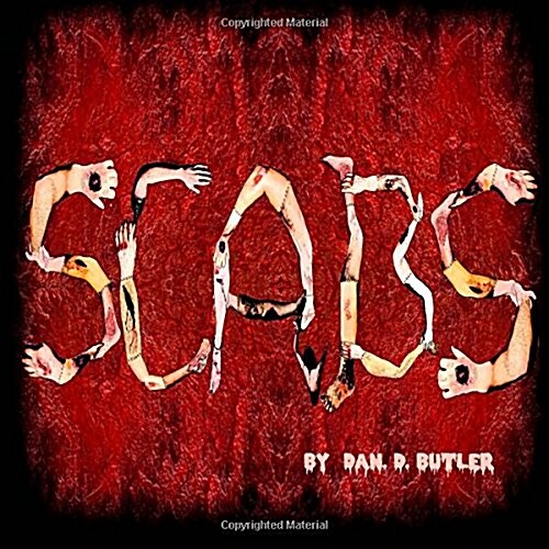 Scabs: Picking Apart the Facts (Paperback)